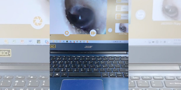 Videootoskop I01 Elite SyncVision - pokaz transmisji obrazu na komputer