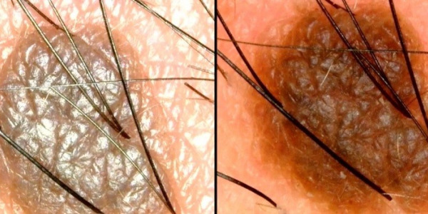 Videodermatoskopy, Trichoskopy, Videootoskopy marki Dino-Lite